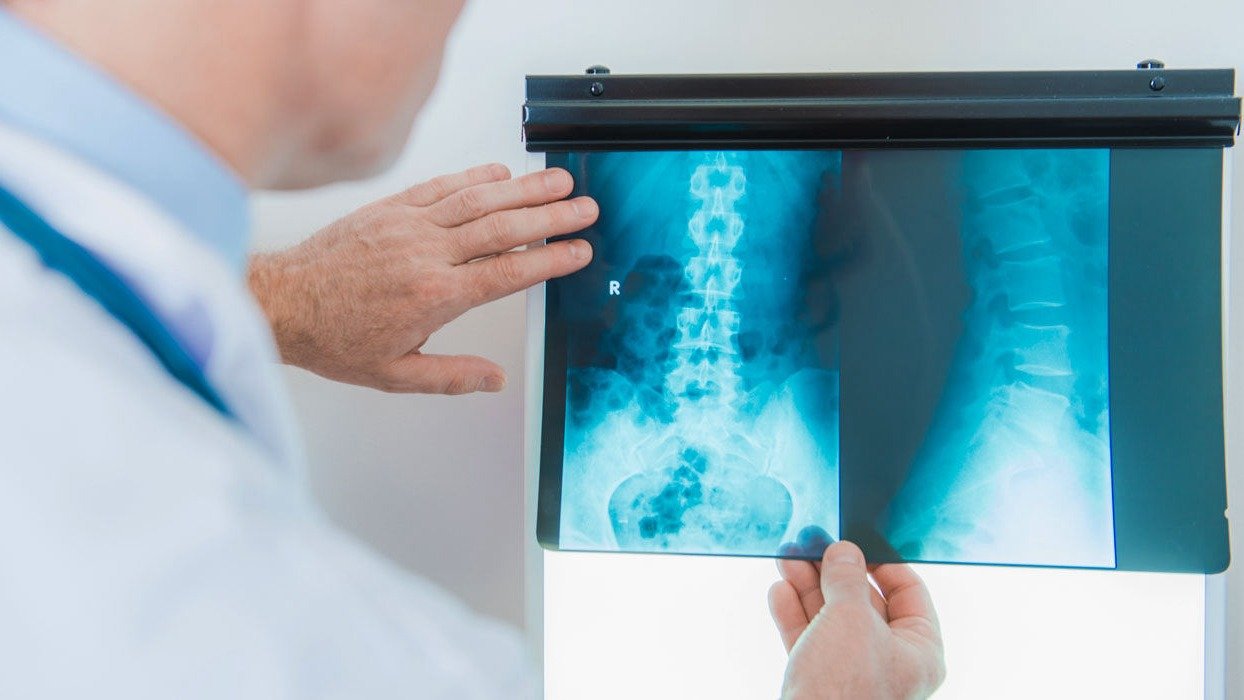 Cirurgia minimamente invasiva para hérnia discal