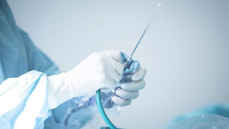 Cirurgia endoscópica de coluna